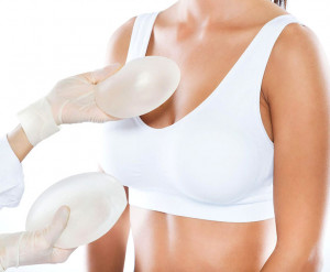 Mammoplastika
