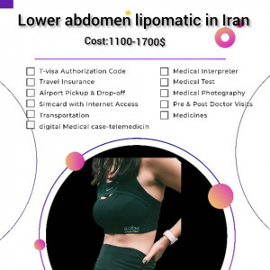 lower abdomen lipomatic surgery in Iran