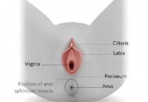 perinoplasty in Iran